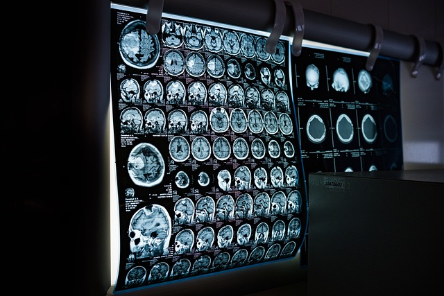 x-ray imagerie médical - DMF Diffusion Médicale France